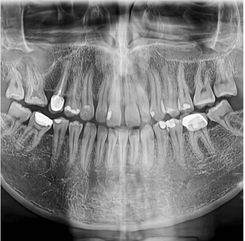 BAD TEETH PRESENTS HAPPY THOUGHTS -WIP